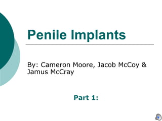 Penile Implants   By: Cameron Moore, Jacob McCoy & Jamus McCray Part 1:   