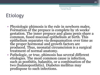 Etiology
• Physiologic phimosis is the rule in newborn males.
Formation of the prepuce is complete by 16 weeks'
gestation. The inner prepuce and glans penis share a
common, fused mucosal epithelium at birth. This
epithelium separates via desquamation over time as
the proper hormonal and growth factors are
produced. Thus, neonatal circumcision is a surgical
treatment of normal anatomy.
• Pathologic, or true, phimosis has several different
etiologies. The most common cause is infection,
such as posthitis, balanitis, or a combination of the
two (balanoposthitis). Diabetes mellitus may
predispose to such infections.
16
Dept of Urology, GRH
and KMC, Chennai.
 