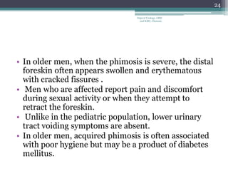 • In older men, when the phimosis is severe, the distal
foreskin often appears swollen and erythematous
with cracked fissures .
• Men who are affected report pain and discomfort
during sexual activity or when they attempt to
retract the foreskin.
• Unlike in the pediatric population, lower urinary
tract voiding symptoms are absent.
• In older men, acquired phimosis is often associated
with poor hygiene but may be a product of diabetes
mellitus.
24
Dept of Urology, GRH
and KMC, Chennai.
 