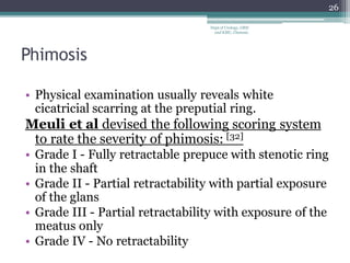 Phimosis
• Physical examination usually reveals white
cicatricial scarring at the preputial ring.
Meuli et al devised the following scoring system
to rate the severity of phimosis: [32]
• Grade I - Fully retractable prepuce with stenotic ring
in the shaft
• Grade II - Partial retractability with partial exposure
of the glans
• Grade III - Partial retractability with exposure of the
meatus only
• Grade IV - No retractability
26
Dept of Urology, GRH
and KMC, Chennai.
 