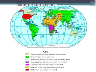 Male circumcision
36
Dept of Urology, GRH
and KMC, Chennai.
 