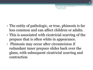 • The entity of pathologic, or true, phimosis is far
less common and can affect children or adults.
• This is associated with cicatricial scarring of the
prepuce that is often white in appearance.
• Phimosis may occur after circumcision if
redundant inner prepuce slides back over the
glans, with subsequent cicatricial scarring and
contraction
4
Dept of Urology, GRH
and KMC, Chennai.
 