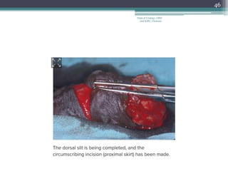 46
Dept of Urology, GRH
and KMC, Chennai.
 