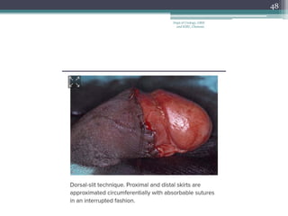 48
Dept of Urology, GRH
and KMC, Chennai.
 