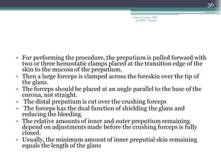 • For performing the procedure, the preputium is pulled forward with
two or three hemostatic clamps placed at the transition edge of the
skin to the mucosa of the preputium.
• Then a large forceps is clamped across the foreskin over the tip of
the glans.
• The forceps should be placed at an angle parallel to the base of the
corona, not straight.
• The distal preputium is cut over the crushing forceps
• The forceps has the dual function of shielding the glans and
reducing the bleeding.
• The relative amounts of inner and outer preputium remaining
depend on adjustments made before the crushing forceps is fully
closed.
• Usually, the minimum amount of inner preputial skin remaining
equals the length of the glans
56
Dept of Urology, GRH
and KMC, Chennai.
 