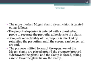 • The more modern Mogen clamp circumcision is carried
out as follows:
• The preputial opening is entered with a blunt edged
probe to separate the preputial adhesions to the glans.
• Complete retractability of the prepuce is checked by
retracting the preputium until the corona can be seen all
around.
• The prepuce is lifted forward, the open jaws of the
Mogen clamp are placed around the prepuce (grooved
side toward the glans), and the clamp is closed, taking
care to leave the glans below the clamp.
62
Dept of Urology, GRH
and KMC, Chennai.
 