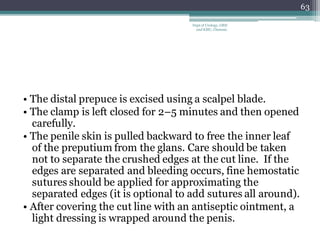 • The distal prepuce is excised using a scalpel blade.
• The clamp is left closed for 2–5 minutes and then opened
carefully.
• The penile skin is pulled backward to free the inner leaf
of the preputium from the glans. Care should be taken
not to separate the crushed edges at the cut line. If the
edges are separated and bleeding occurs, fine hemostatic
sutures should be applied for approximating the
separated edges (it is optional to add sutures all around).
• After covering the cut line with an antiseptic ointment, a
light dressing is wrapped around the penis.
63
Dept of Urology, GRH
and KMC, Chennai.
 