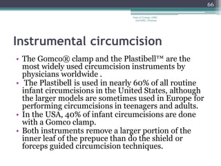 Instrumental circumcision
• The Gomco® clamp and the Plastibell™ are the
most widely used circumcision instruments by
physicians worldwide .
• The Plastibell is used in nearly 60% of all routine
infant circumcisions in the United States, although
the larger models are sometimes used in Europe for
performing circumcisions in teenagers and adults.
• In the USA, 40% of infant circumcisions are done
with a Gomco clamp.
• Both instruments remove a larger portion of the
inner leaf of the prepuce than do the shield or
forceps guided circumcision techniques.
66
Dept of Urology, GRH
and KMC, Chennai.
 