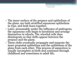 • The inner surface of the prepuce and epithelium of
the glans, are both stratified squamous epithelium
in type, and both fuses together.
• Later, presumably under the influence of androgens,
the squamous cells begin to keratinize and arrange
themselves in whorls. The whorled cells then
disintegrate so that clefts appear between the
prepuce and the glans.
• These clefts eventually propagate and separate the
inner preputial epithelium and the epithelium of the
glans from each other. This process of separation is
usually incomplete at birth and continues through
childhood and sometimes to adult life.
7
Dept of Urology, GRH
and KMC, Chennai.
 