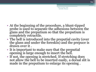 • At the beginning of the procedure, a blunt-tipped
probe is used to separate the adhesions between the
glans and the preputium so that the preputium is
completely retractile.
• The bell is introduced into the preputial cavity (over
the glans and under the foreskin) and the prepuce is
drawn over it .
• It is important to make sure that the preputial
opening is large enough to insert the bell.
• If not, the opening is stretched. If stretching does
not allow the bell to be inserted easily, a dorsal slit is
made in the preputium to enlarge its opening .
70
Dept of Urology, GRH
and KMC, Chennai.
 