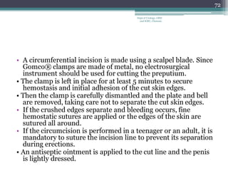 • A circumferential incision is made using a scalpel blade. Since
Gomco® clamps are made of metal, no electrosurgical
instrument should be used for cutting the preputium.
• The clamp is left in place for at least 5 minutes to secure
hemostasis and initial adhesion of the cut skin edges.
• Then the clamp is carefully dismantled and the plate and bell
are removed, taking care not to separate the cut skin edges.
• If the crushed edges separate and bleeding occurs, fine
hemostatic sutures are applied or the edges of the skin are
sutured all around.
• If the circumcision is performed in a teenager or an adult, it is
mandatory to suture the incision line to prevent its separation
during erections.
• An antiseptic ointment is applied to the cut line and the penis
is lightly dressed.
72
Dept of Urology, GRH
and KMC, Chennai.
 
