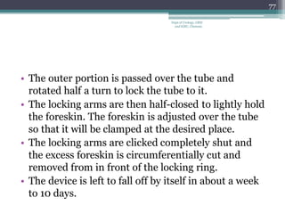 • The outer portion is passed over the tube and
rotated half a turn to lock the tube to it.
• The locking arms are then half-closed to lightly hold
the foreskin. The foreskin is adjusted over the tube
so that it will be clamped at the desired place.
• The locking arms are clicked completely shut and
the excess foreskin is circumferentially cut and
removed from in front of the locking ring.
• The device is left to fall off by itself in about a week
to 10 days.
77
Dept of Urology, GRH
and KMC, Chennai.
 
