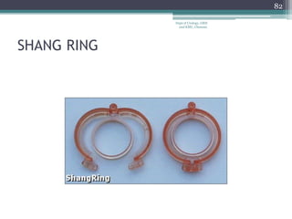 SHANG RING
82
Dept of Urology, GRH
and KMC, Chennai.
 