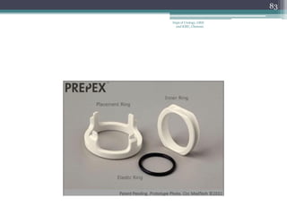 83
Dept of Urology, GRH
and KMC, Chennai.
 