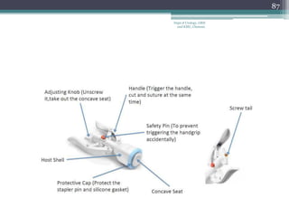 87
Dept of Urology, GRH
and KMC, Chennai.
 