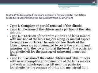 Toubia (1994) classified the more extensive female genital mutilation
procedures according to the amount of tissue destruction:
• Type I: Complete or partial removal of the clitoris.
• Type II: Excision of the clitoris and a portion of the labia
minora.
• Type III: Excision of the entire clitoris and labia minora
with incision of the labia majora along its medial aspect
to create raw surfaces.The anterior two thirds of the
labia majora are approximated to cover the urethra and
introitus, with the lower third at the level of the posterior
fourchette left for the passage of urine and menstrual
fluid.
• Type IV: Excision of the entire clitoris and labia minora
with nearly complete approximation of the labia majora
and only a pinhole opening left near the posterior
fourchette for the passage of urine and menstrual fluid
91
Dept of Urology, GRH
and KMC, Chennai.
 
