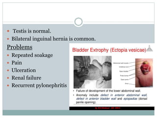  Testis is normal.
 Bilateral inguinal hernia is common.
Problems
 Repeated soakage
 Pain
 Ulceration
 Renal failure
 Recurrent pylonephritis
 