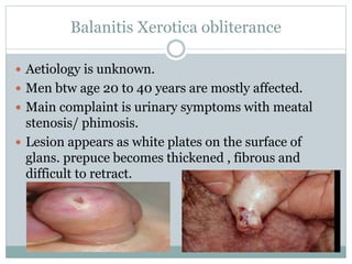 Balanitis Xerotica obliterance
 Aetiology is unknown.
 Men btw age 20 to 40 years are mostly affected.
 Main complaint is urinary symptoms with meatal
stenosis/ phimosis.
 Lesion appears as white plates on the surface of
glans. prepuce becomes thickened , fibrous and
difficult to retract.
 