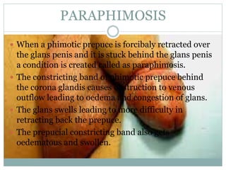 PARAPHIMOSIS
 When a phimotic prepuce is forcibaly retracted over
the glans penis and it is stuck behind the glans penis
a condition is created called as paraphimosis.
 The constricting band of phimotic prepuce behind
the corona glandis causes obstruction to venous
outflow leading to oedema and congestion of glans.
 The glans swells leading to more difficulty in
retracting back the prepuce.
 The prepucial constricting band also gets
oedematous and swollen.
 