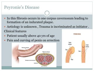 Peyronie’s Disease
 In this fibrosis occurs in one corpus cavernosum leading to
formation of an indurated plaque.
 Aetiology is unknown , Trauma is incriminated as initiator .
Clinical features
 Patient usually above 40 yrs of age
 Pain and curving of penis on errection
 