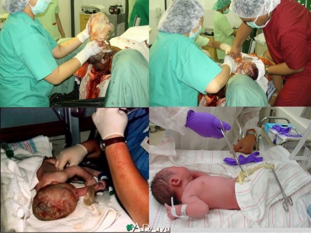 penjagaan bayi baru lahir