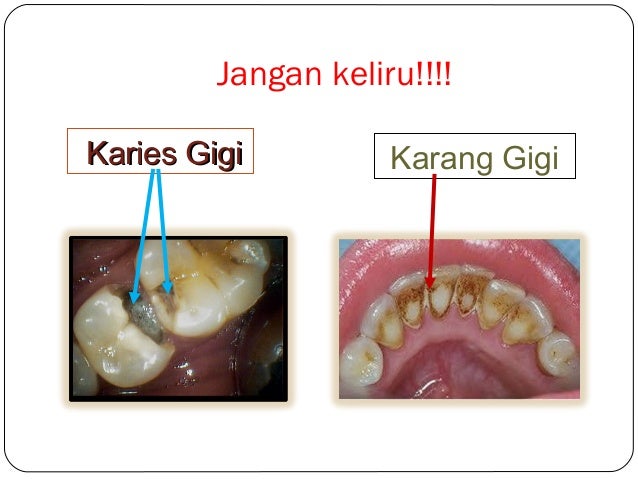 Penjagaan gigi