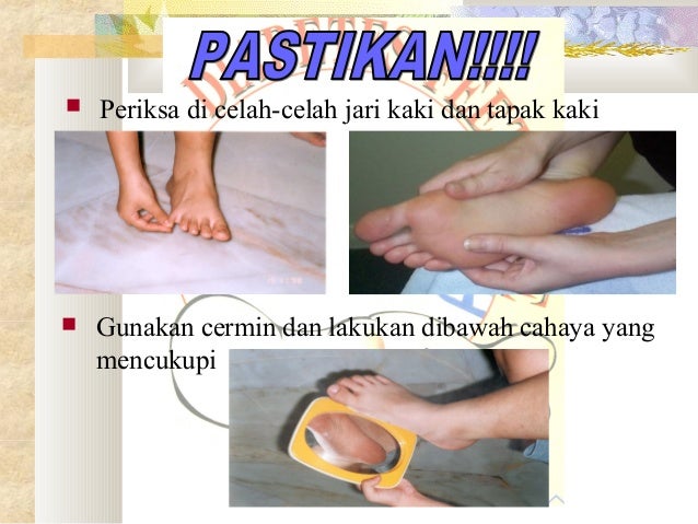 Penjagaan kaki