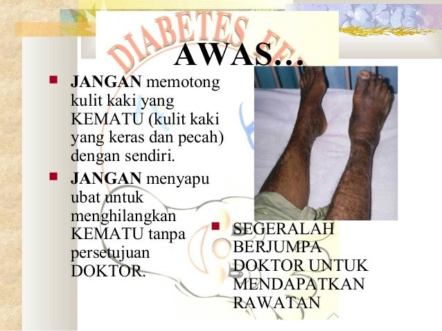 Penjagaan kaki