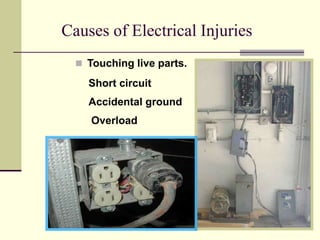 13
Causes of Electrical Injuries
 Touching live parts.
Short circuit
Accidental ground
Overload
 