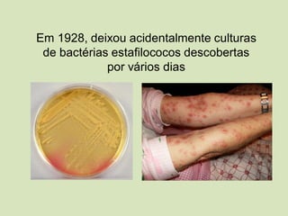 Em 1928, deixou acidentalmente culturas
de bactérias estafilococos descobertas
por vários dias
 