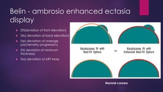 Belin - ambrosio enhanced ectasia
display
 Df(deviation of front elevation)
 Db( deviation of back elevation)
 Dp( deviation of average
pachemetry progression)
 Dt( deviation of minimum
thickness)
 Da( deviation of ART Max)
Normal cornea
 