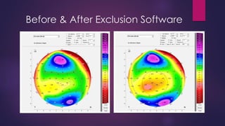Before & After Exclusion Software
 