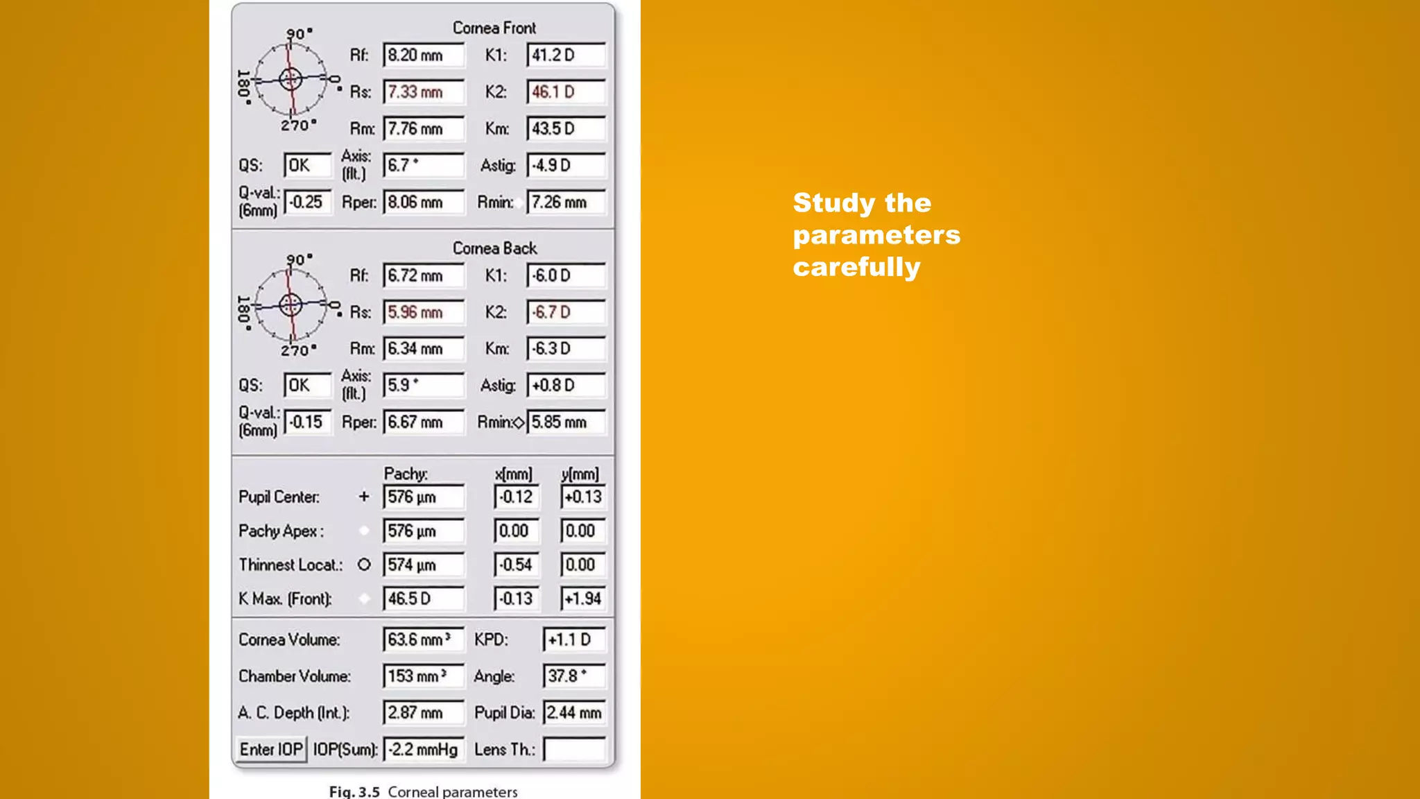 Study the
parameters
carefully
 