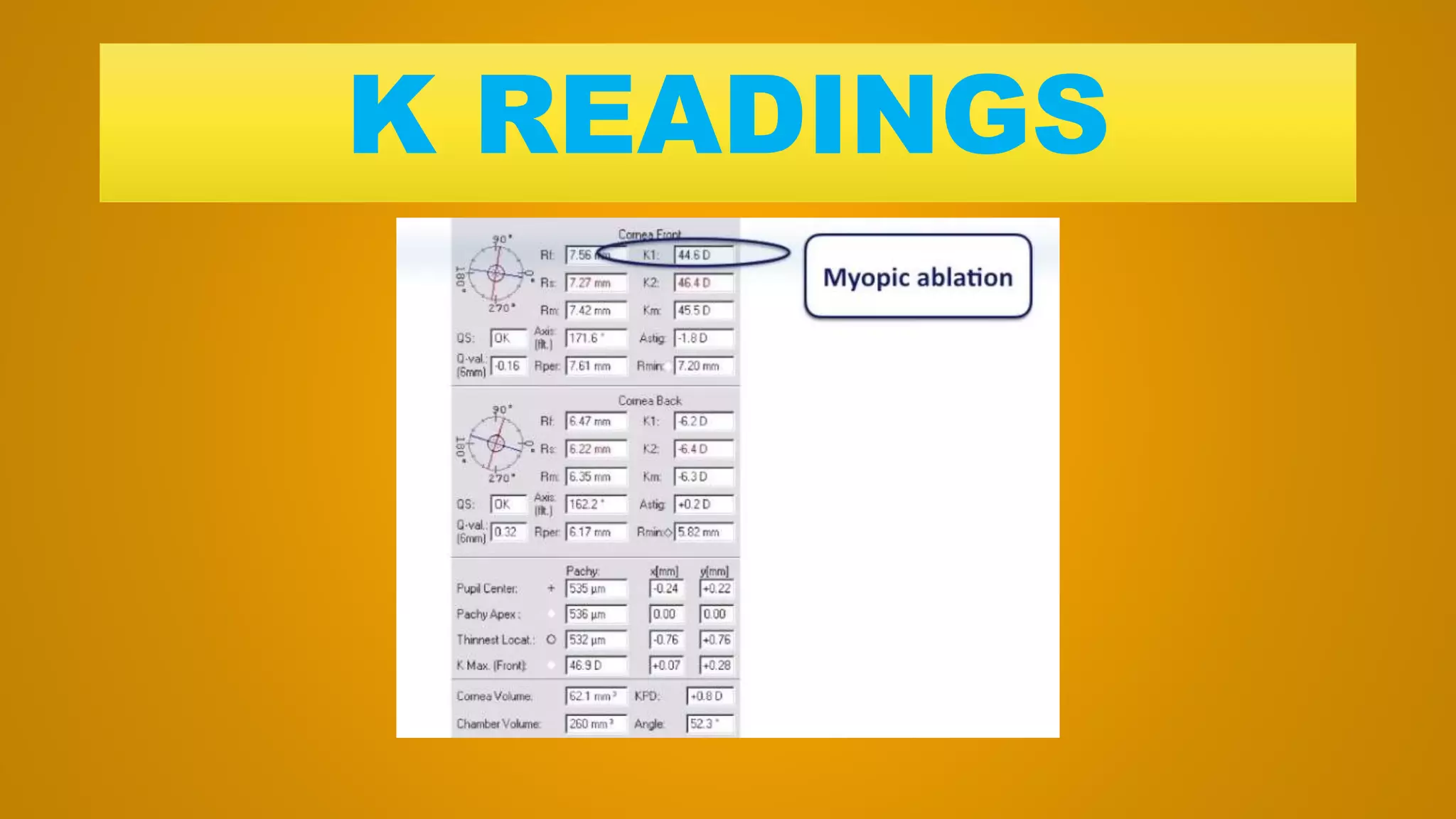K READINGS
 