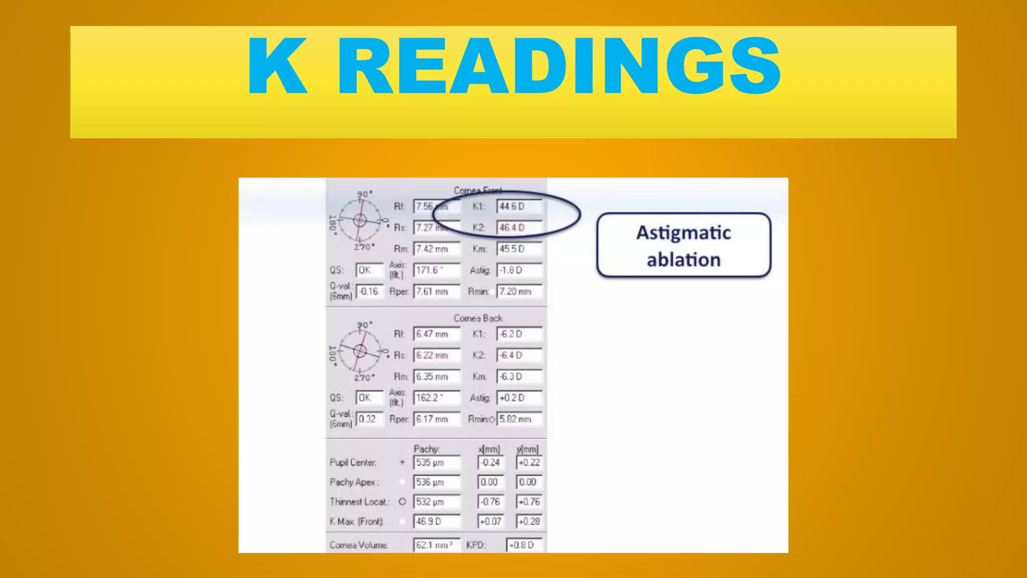 K READINGS
 