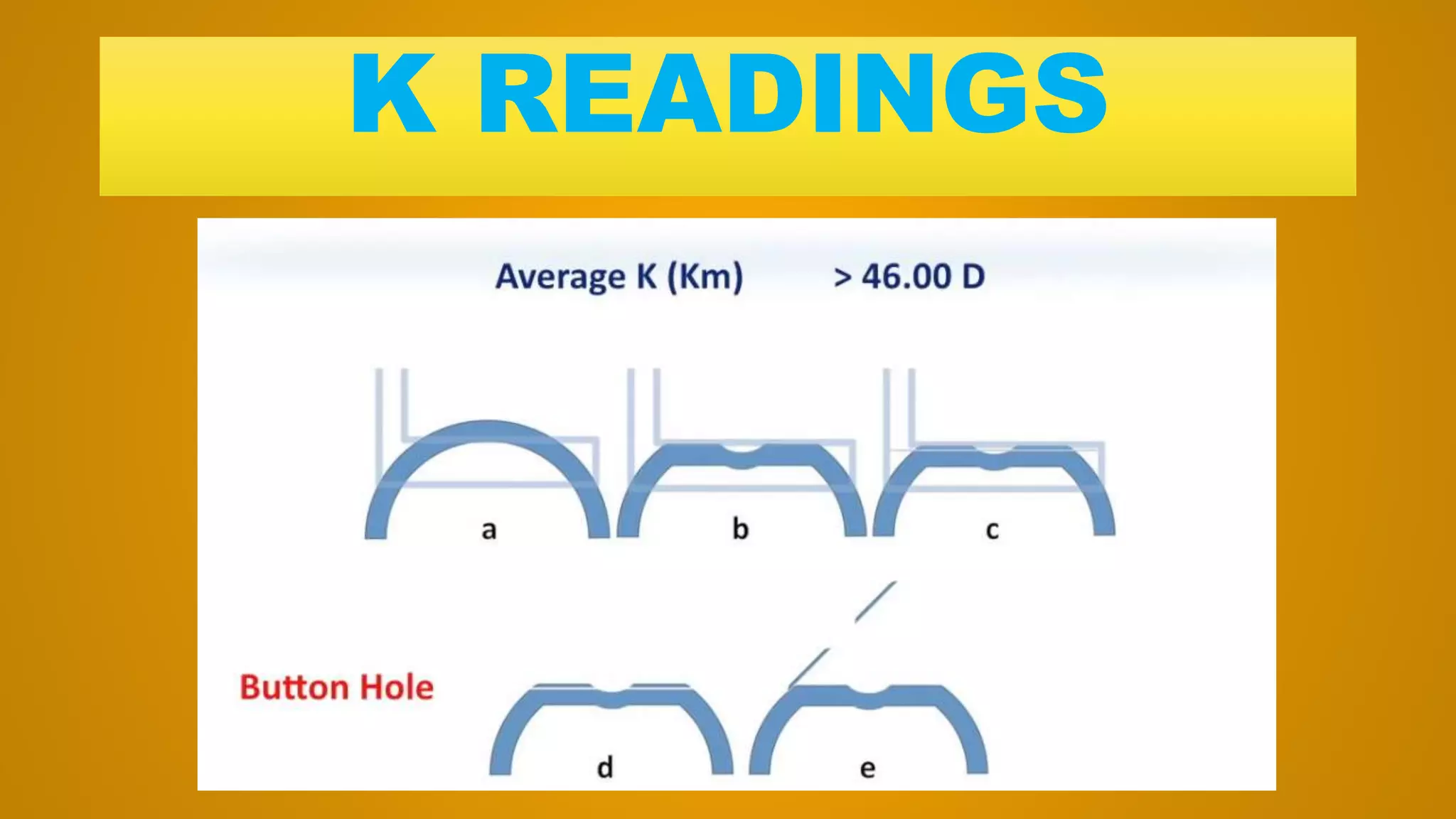 K READINGS
 
