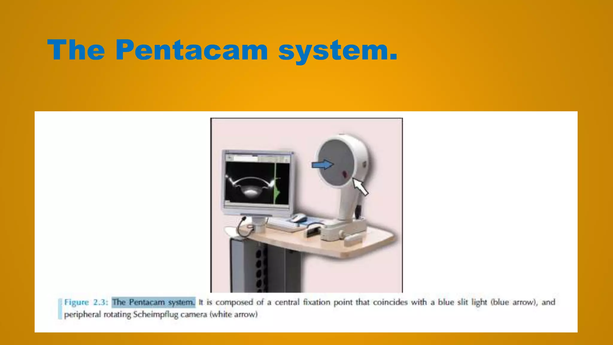 The Pentacam system.
 
