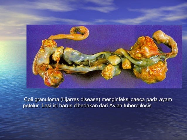 Peny. ungg (coli, fc, salm, pull, ic, crd)