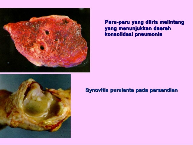 Peny. ungg (coli, fc, salm, pull, ic, crd)