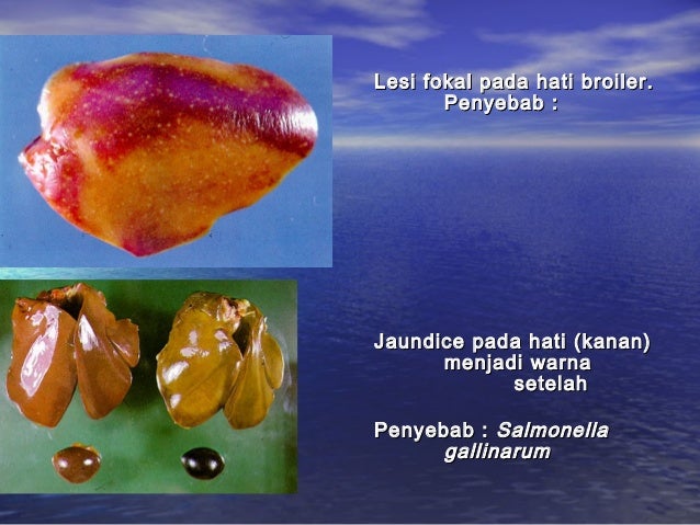 Peny. ungg (coli, fc, salm, pull, ic, crd)