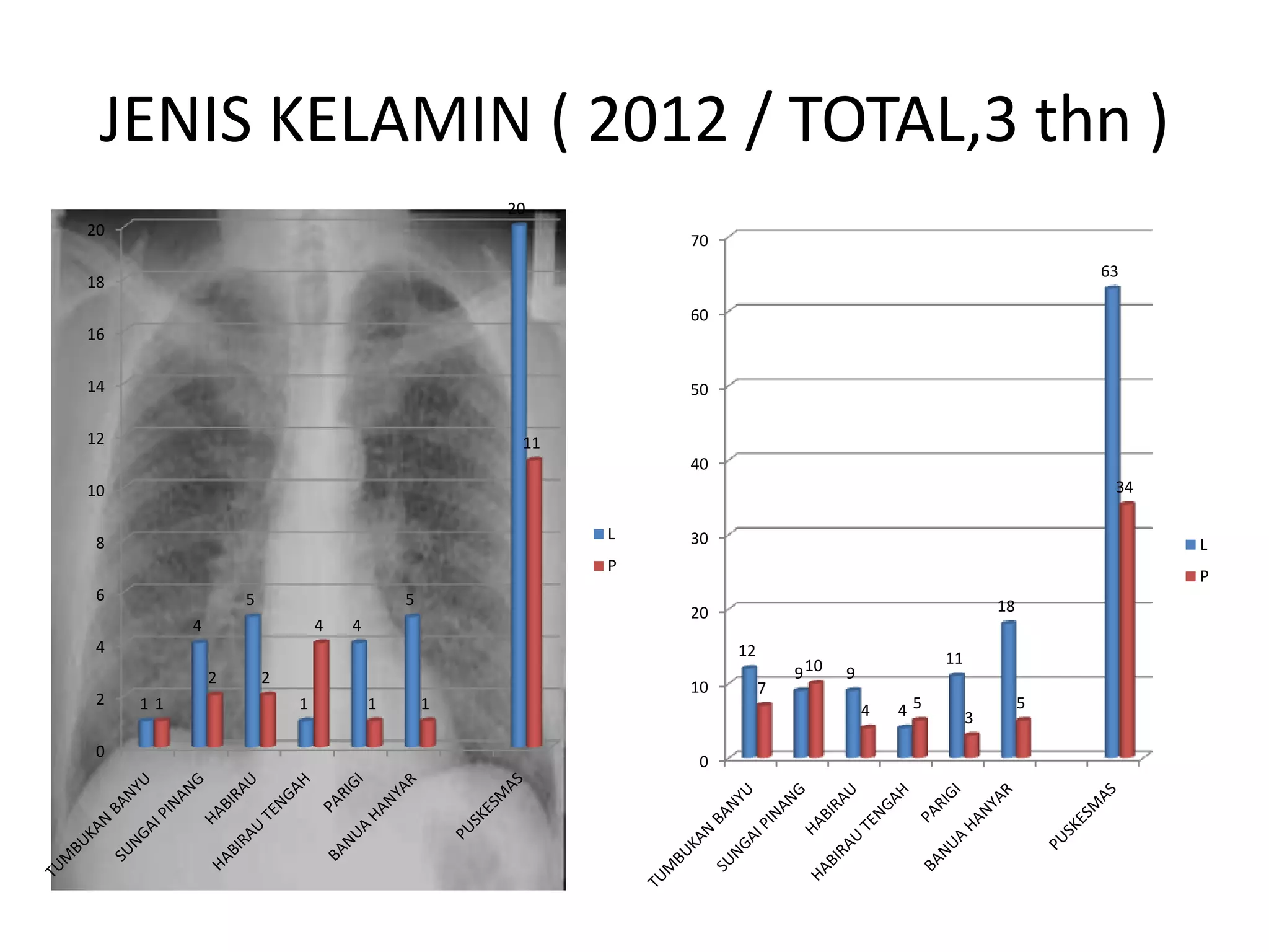 JENIS KELAMIN ( 2012 / TOTAL,3 thn )
0
2
4
6
8
10
12
14
16
18
20
1
4
5
1
4
5
20
1
2 2
4
1 1
11
L
P
0
10
20
30
40
50
60
70
12
9 9
4
11
18
63
7
10
4 5
3
5
34
L
P
 