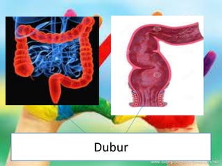 Dubur
 