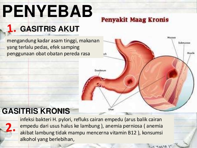  Penyakit Pencernaan  Biology Kelas XI