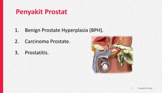 Penyakit Prostat
1. Benign Prostate Hyperplasia (BPH).
2. Carcinoma Prostate.
3. Prostatitis.
1 Penyakit Prostat
 