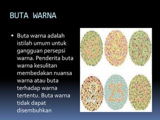 BUTA WARNA
 Buta warna adalah
istilah umum untuk

gangguan persepsi
warna. Penderita buta
warna kesulitan
membedakan nuansa
warna atau buta
terhadap warna
tertentu. Buta warna
tidak dapat
disembuhkan

 