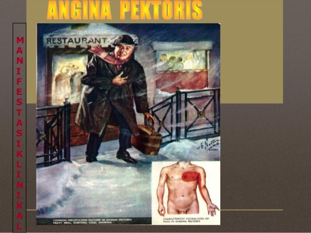 PENYAKIT ISKEMIK KARDIAK - Angina Pectoris