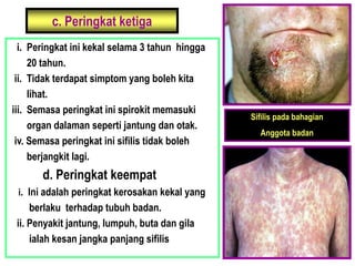 c. Peringkat ketiga
i. Peringkat ini kekal selama 3 tahun hingga
20 tahun.
ii. Tidak terdapat simptom yang boleh kita
lihat.
iii. Semasa peringkat ini spirokit memasuki
organ dalaman seperti jantung dan otak.
iv. Semasa peringkat ini sifilis tidak boleh
berjangkit lagi.
d. Peringkat keempat
i. Ini adalah peringkat kerosakan kekal yang
berlaku terhadap tubuh badan.
ii. Penyakit jantung, lumpuh, buta dan gila
ialah kesan jangka panjang sifilis.
Sifilis pada bahagian
Anggota badan
 