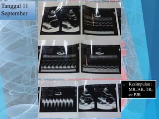 Tanggal 11
September
 Kesimpulan :
MR, AR, TR,
ec PJR
 
