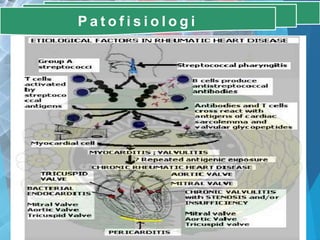 P a t o f i s i o l o g i
 