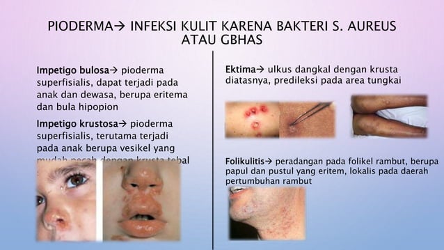 PPT Penyakit Kulit Infeksi Bakteri.pptx